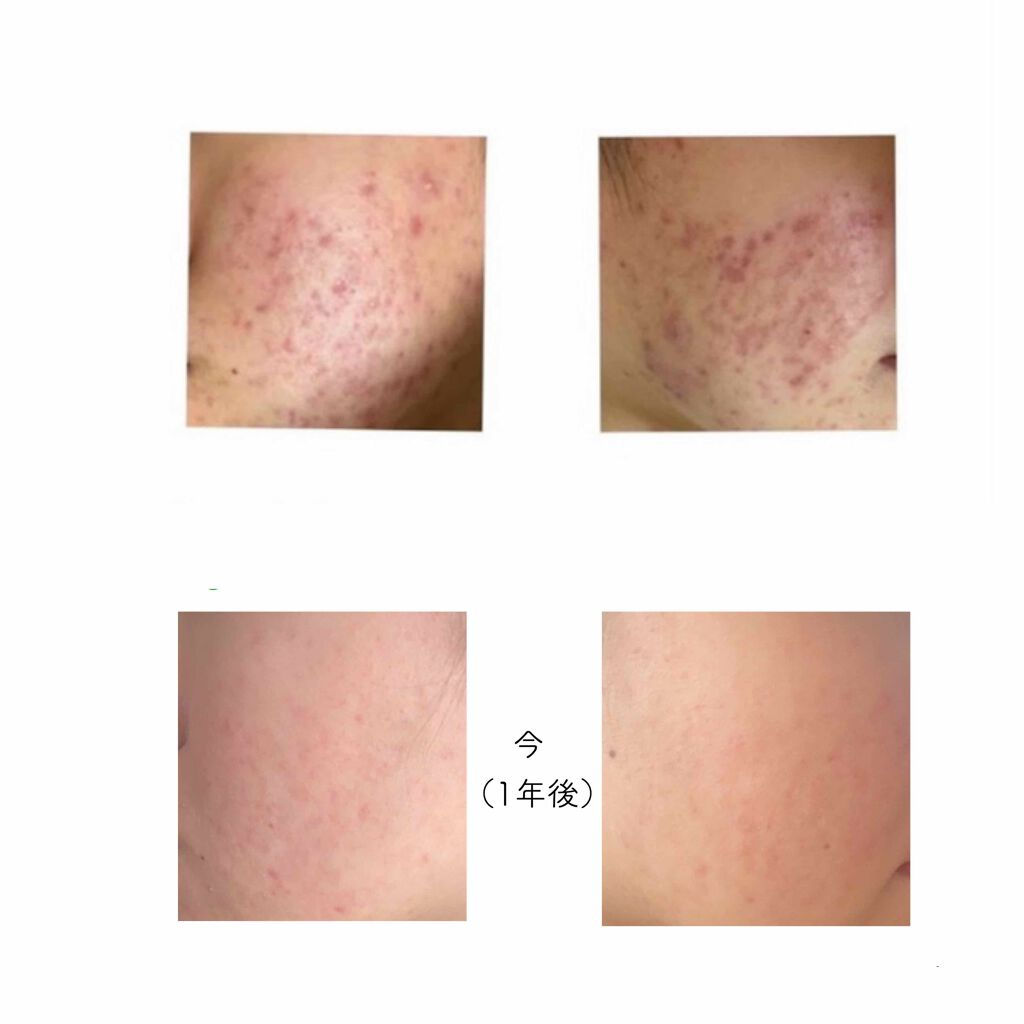 ビジャ シカバーム EX/innisfree/フェイスバームを使ったクチコミ（3枚目）