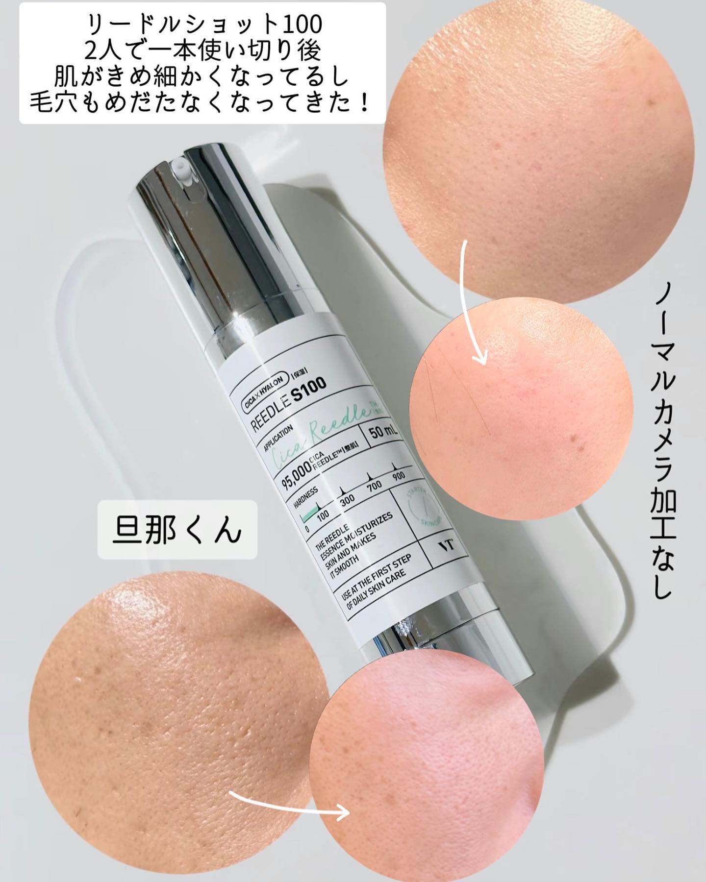 リードルショット300｜VTの効果に関する口コミ - リードル