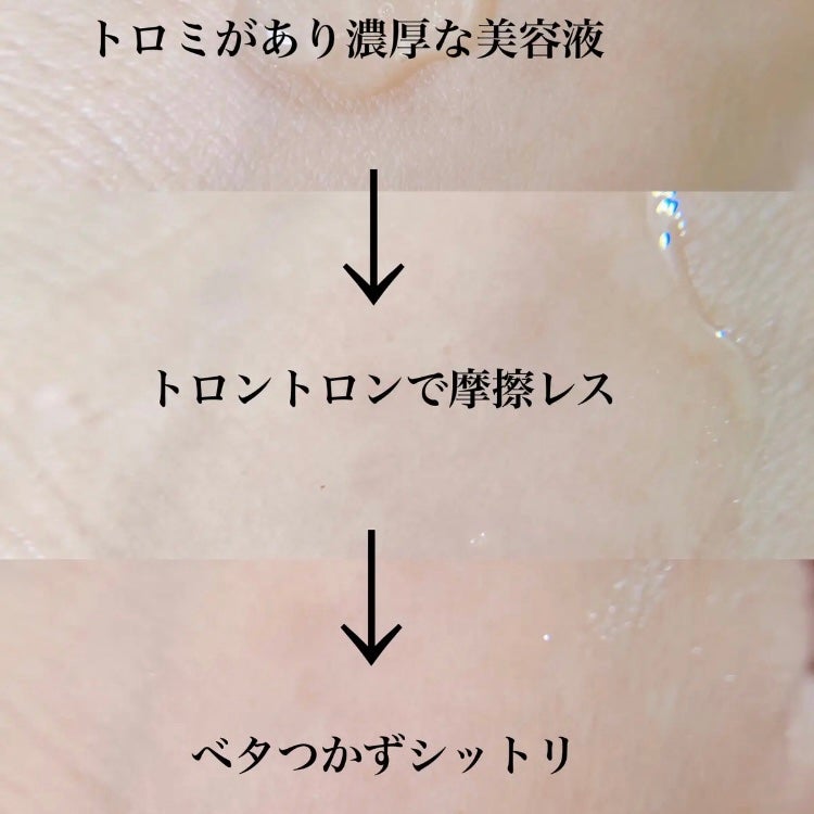 ブレミッシュケアアップ セラム/ISOI/美容液を使ったクチコミ(4枚目)