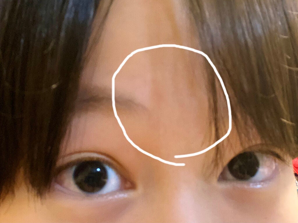 薬用アクネコントロール フレッシュ ローション/DHC/化粧水を使ったクチコミ(3枚目)