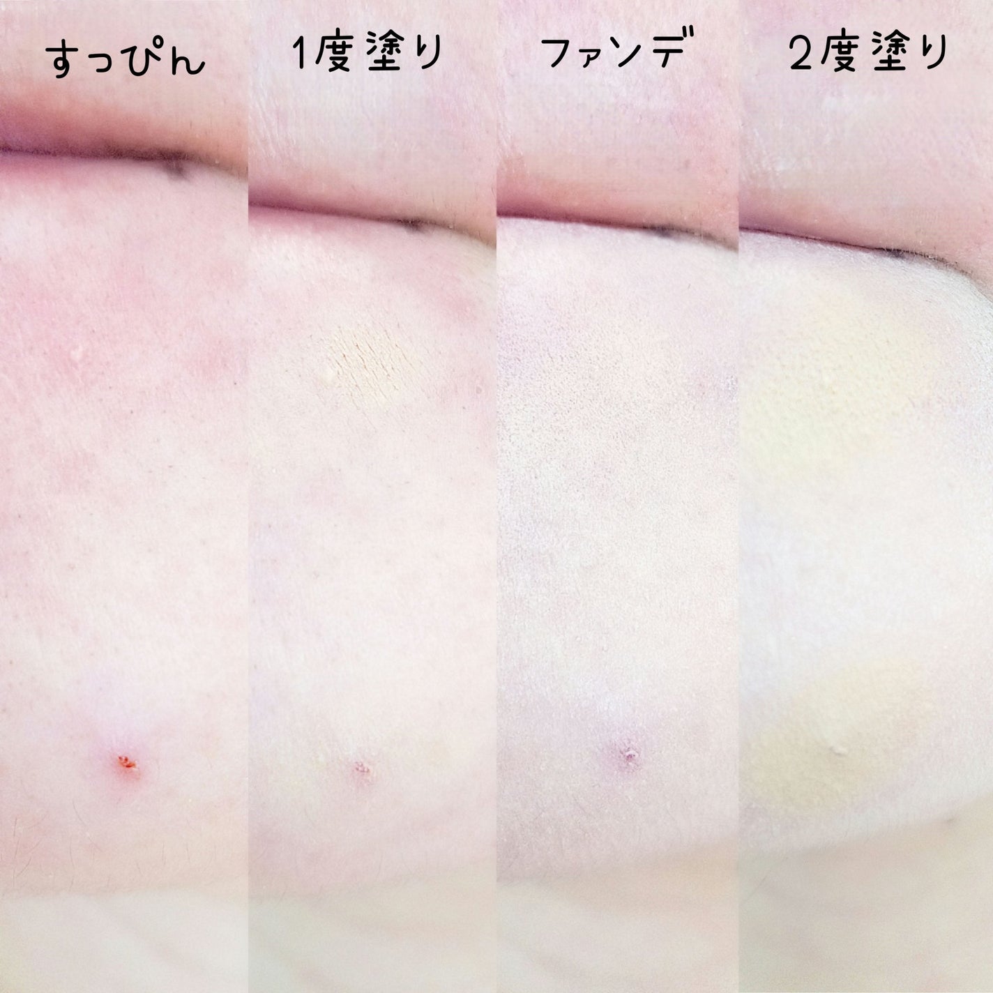 薬用コンシーラー アクネプロテクター/ONLY MINERALS/パウダーコンシーラーを使ったクチコミ(3枚目)