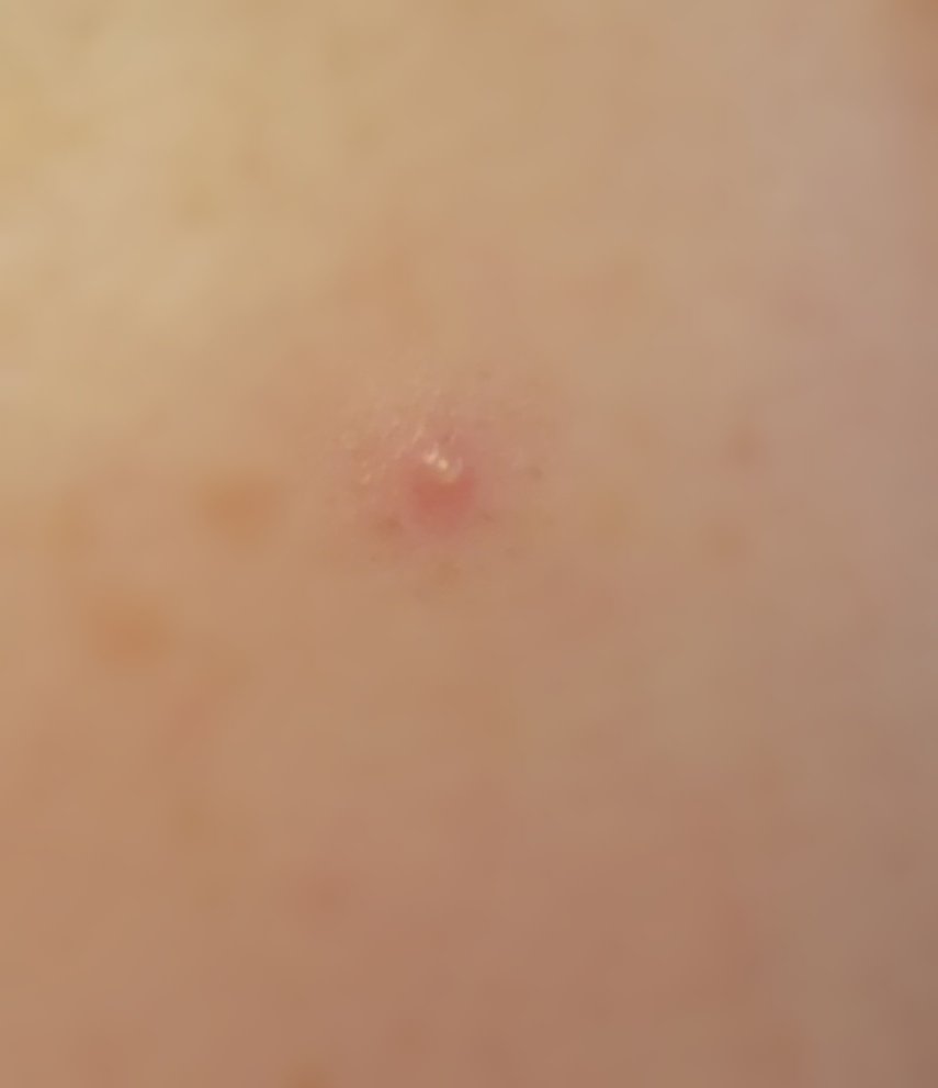 カバーパーフェクション チップコンシーラー 1.25 ライトベージュ/the SAEM/リキッドコンシーラーを使ったクチコミ（2枚目）