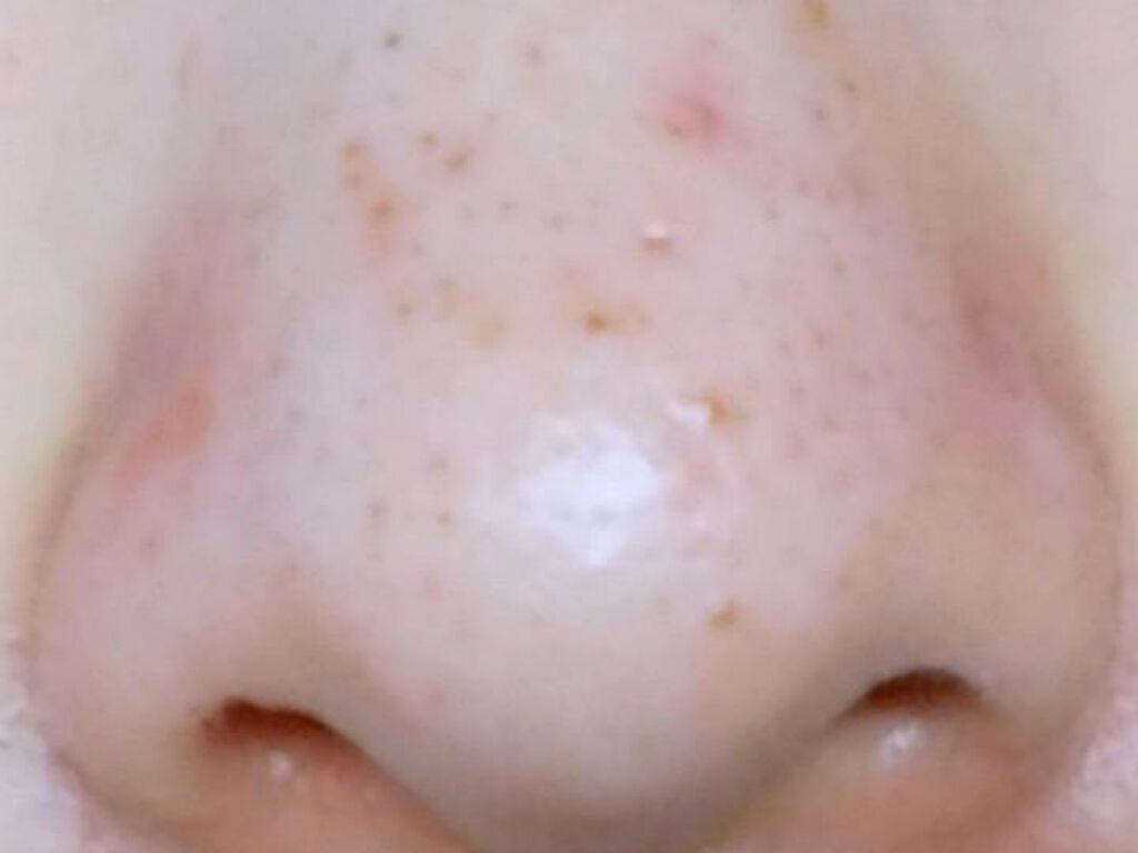 パワーマスク SP/ラッシュ/スクラブ・ゴマージュを使ったクチコミ(2枚目)