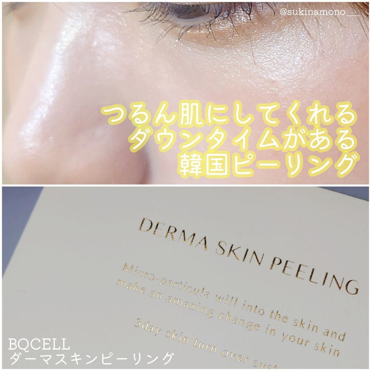 ダーマスキンピーリング|BQCELLの口コミ - 🥚つるんと ダーマスキンピーリング|BQCELLの口コミ - 🥚つるんと
