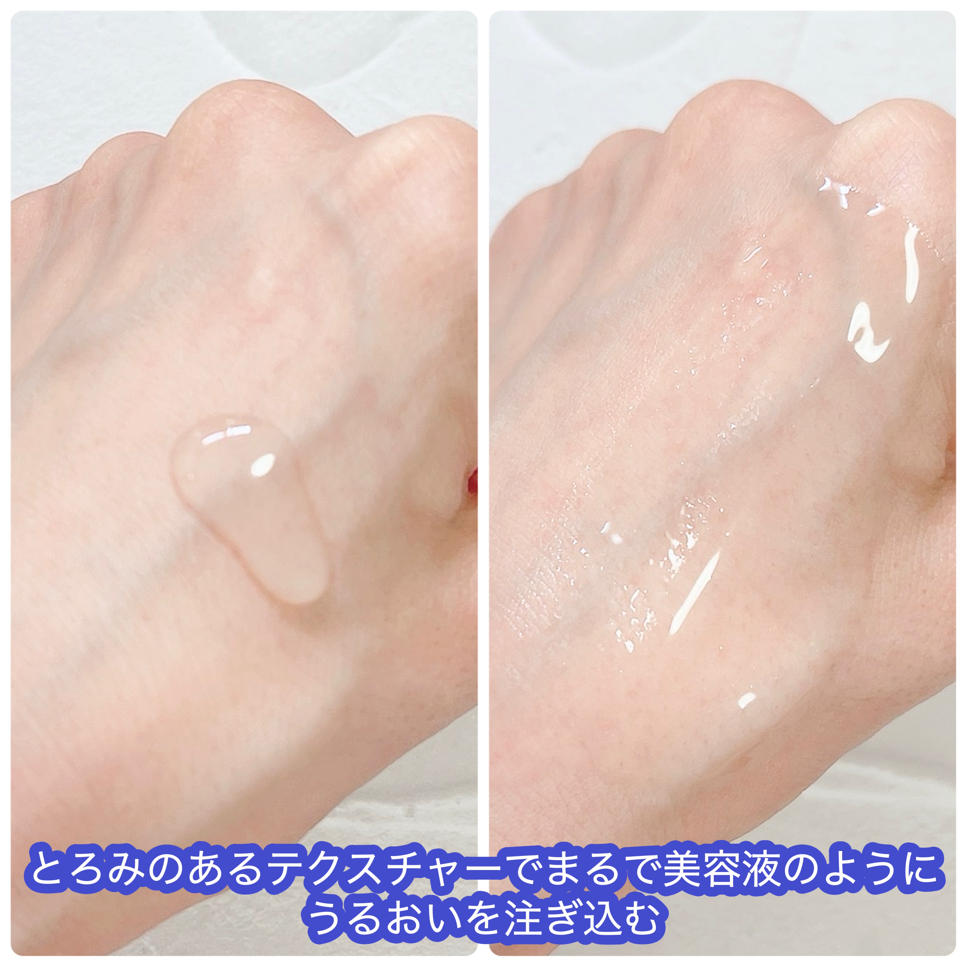 トリートメントローション （ブライトニング） とてもしっとり/アクアレーベル/化粧水を使ったクチコミ（2枚目）