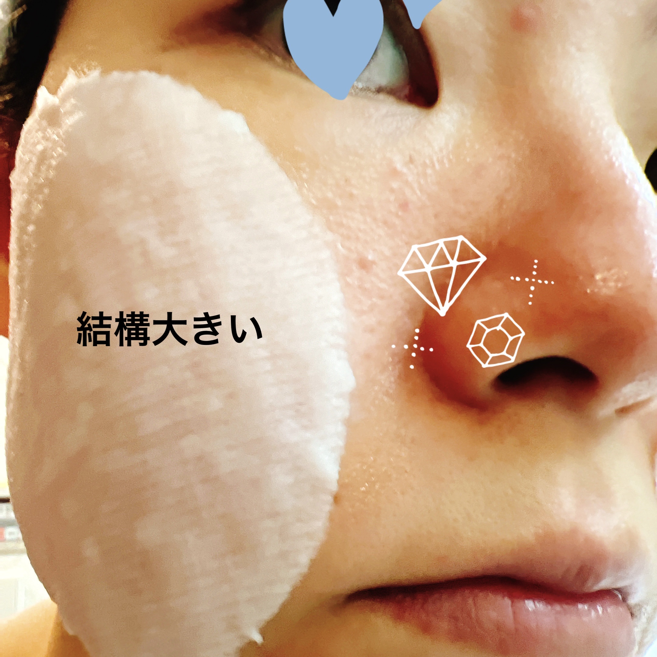 リアルナイアシンアミドグローアップデイリーマスク/NEOGEN/その他スキンケアを使ったクチコミ（3枚目）