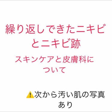 雪肌精 薬用 雪肌精のクチコミ「

汚い肌失礼します😭😇

高校生くらいからずっとニキビに悩んでいて、同じところにできて治って.....」（1枚目）