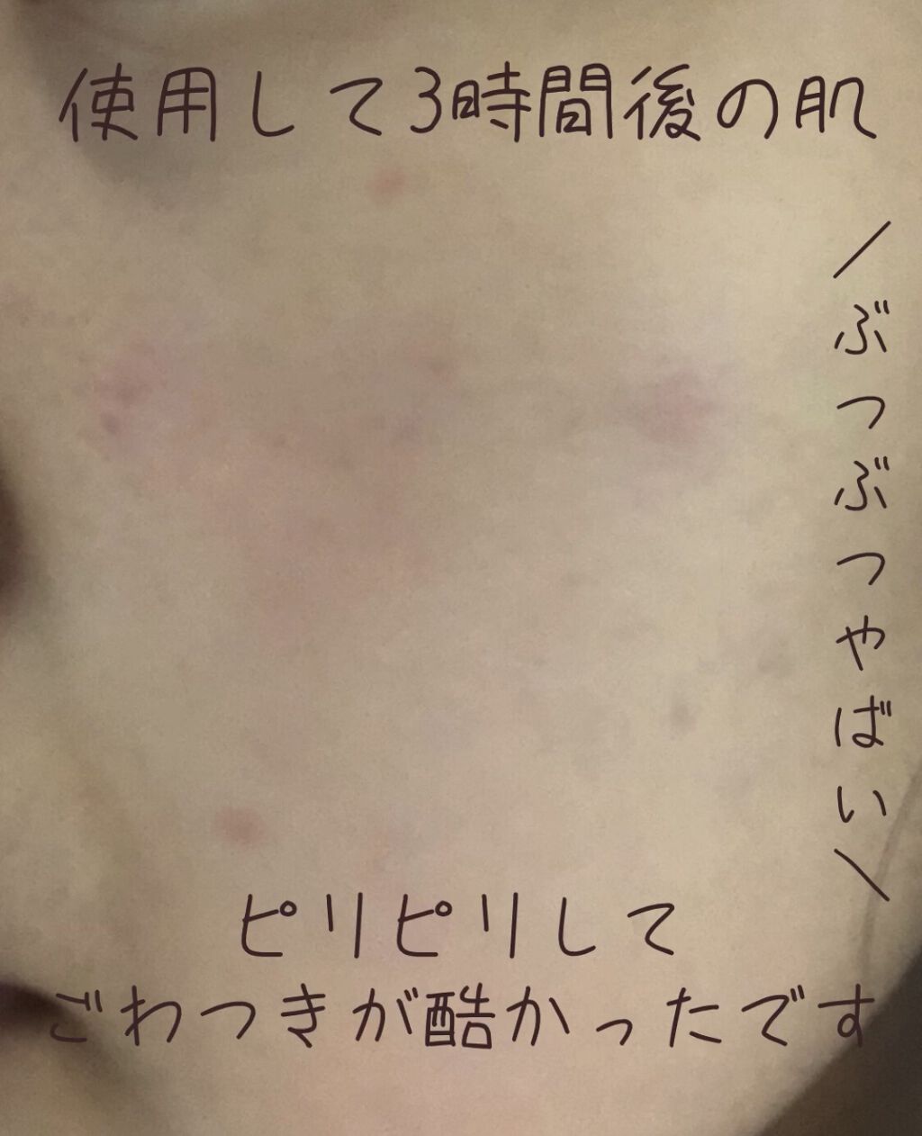 エイジングケア薬用リンクルケアクリームマスク/無印良品/フェイスクリームを使ったクチコミ（1枚目）