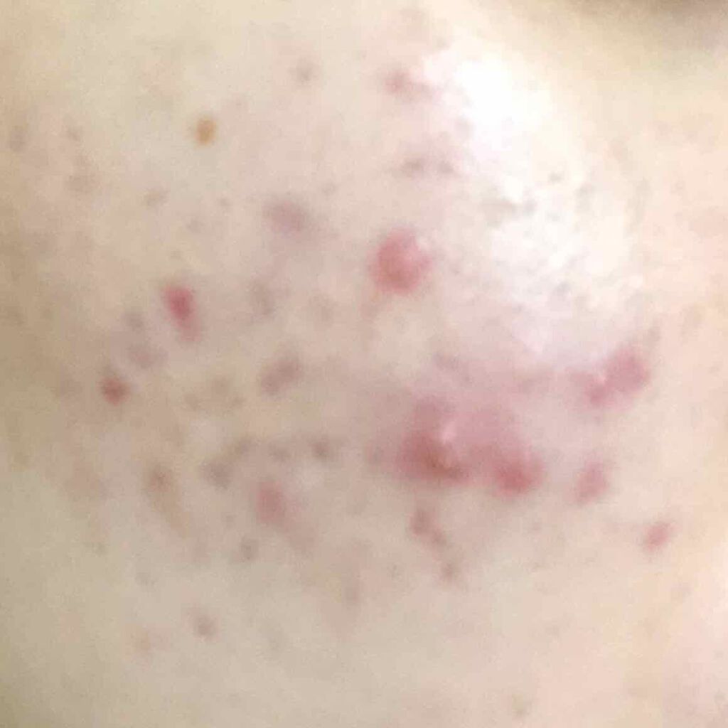 ヴァセリン アドバンスドリペア ボディローション 無香料/ヴァセリン/ボディローションを使ったクチコミ（3枚目）