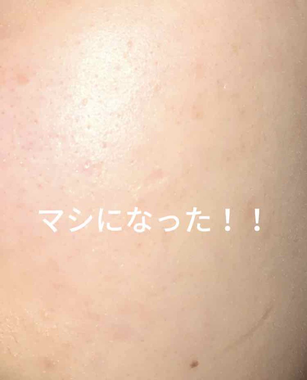 ルルルンピュア 青 （モイスト）/ルルルン/シートマスク・パックを使ったクチコミ（3枚目）