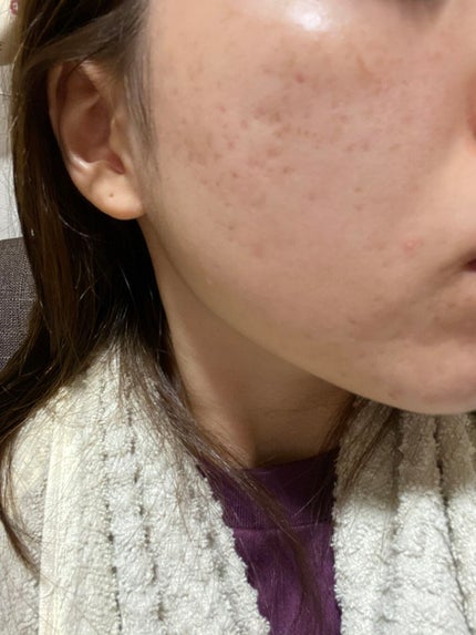 フレッシュリージュースドビタミンドロップ(35ml)/Klairs/美容液を使ったクチコミ(2枚目)