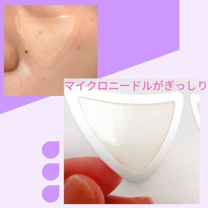 試してみた】チークポアパッチ 北の快適工房の効果・肌質別の 試してみた】チークポアパッチ 北の快適工房の効果・肌質別の