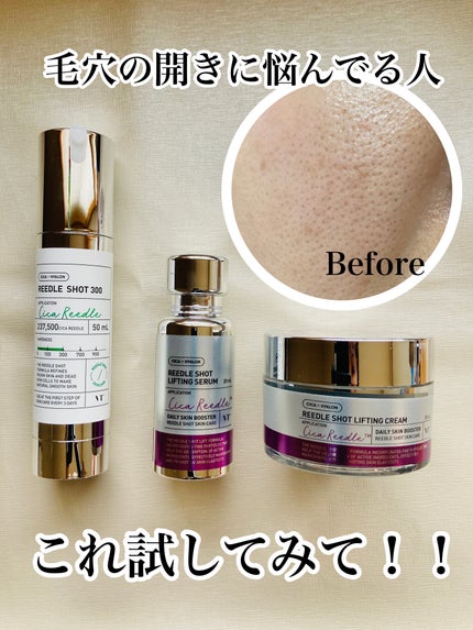 リードルショット300/VT/美容液を使ったクチコミ(1枚目)
