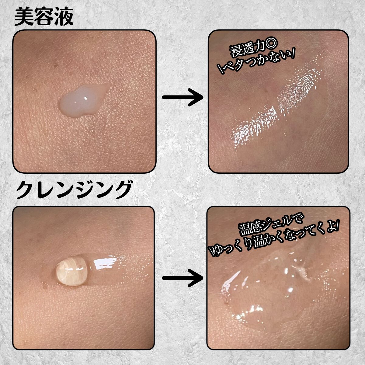 チョコブラ スペシャル毛穴ケアセット/Chocobra/スキンケアキットを使ったクチコミ（3枚目）