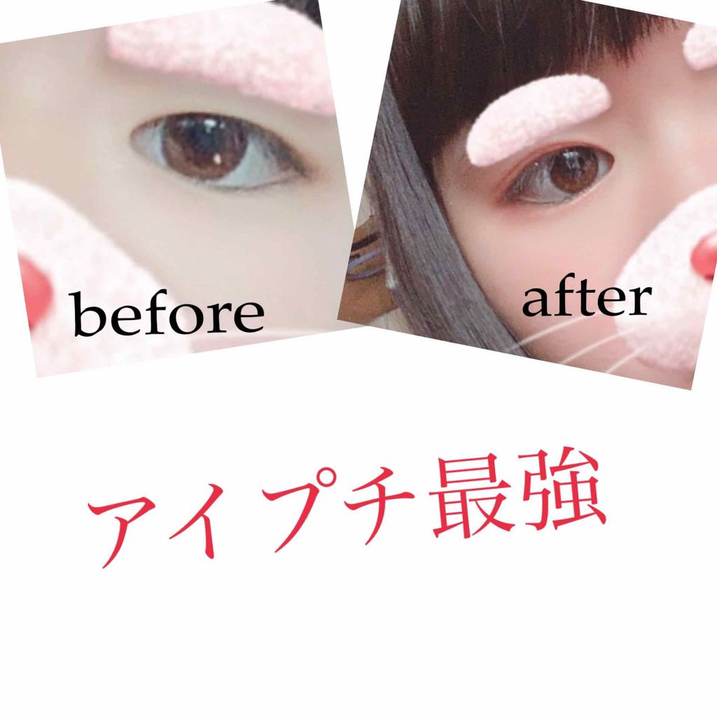 アイトーク/アイトーク/二重まぶた用アイテムを使ったクチコミ（1枚目）