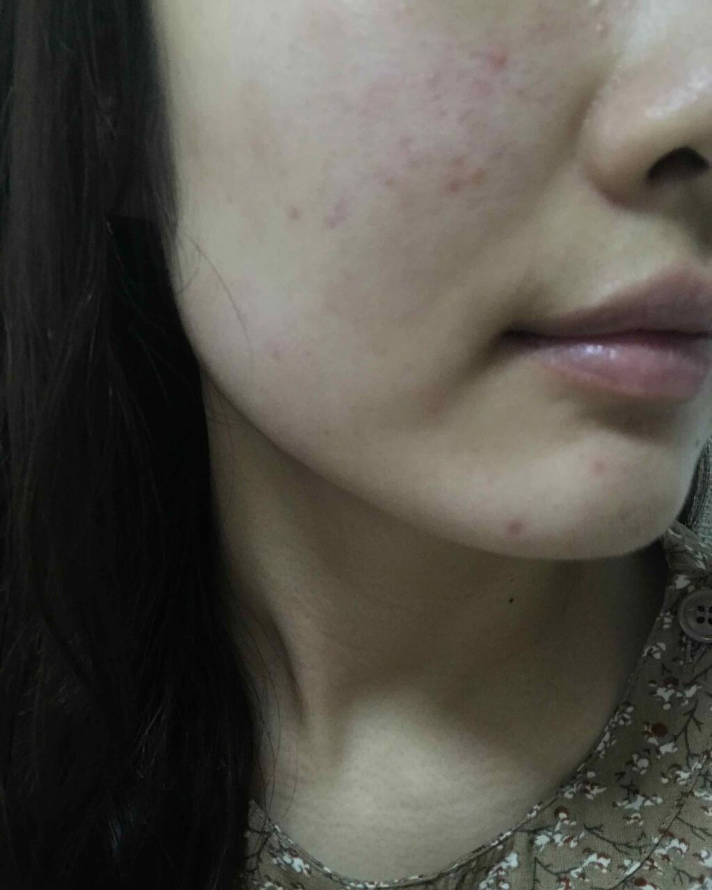 チョコラBBプラス (医薬品)/チョコラBB/その他を使ったクチコミ(1枚目)