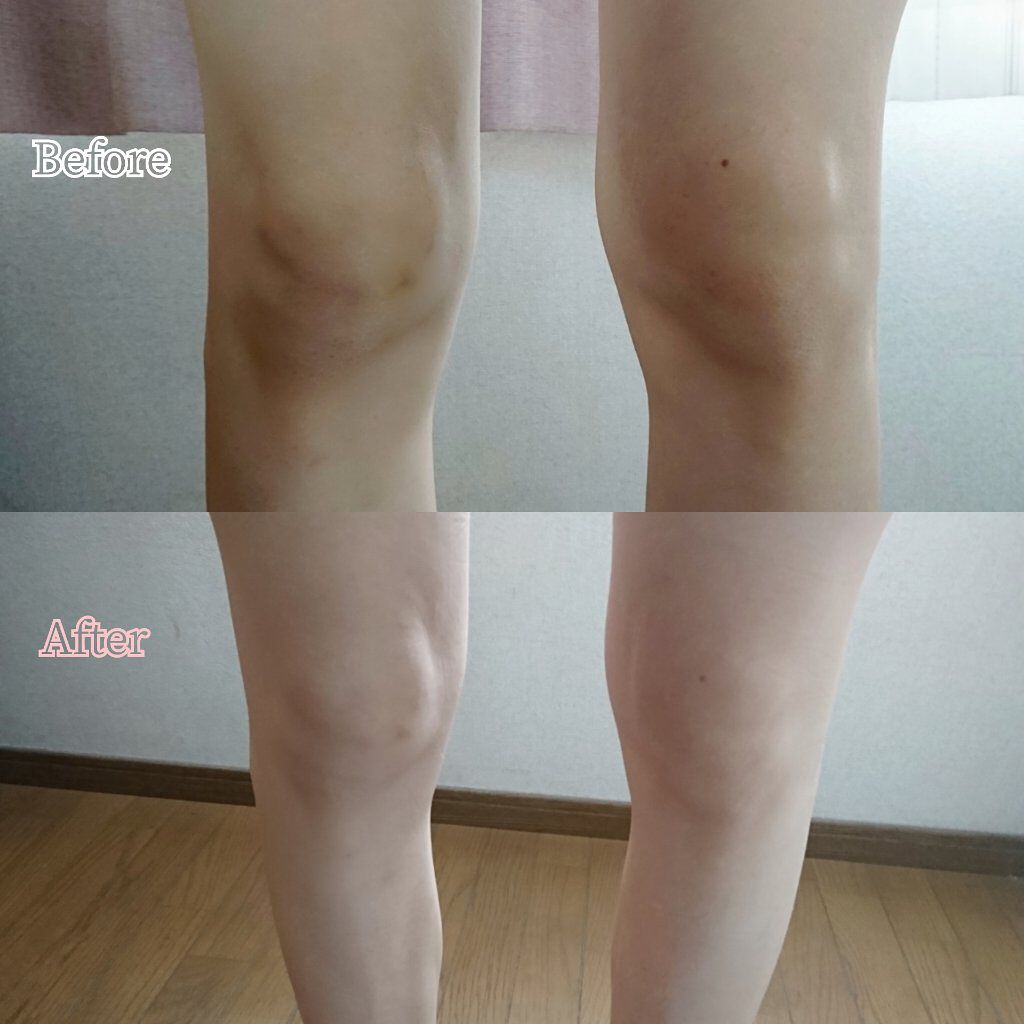 ひざピーリングジェル/コヒザドール/レッグ・フットケアを使ったクチコミ(8枚目)