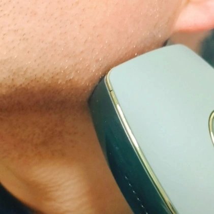 スムーズスキン pure/スムーズスキン/家庭用脱毛器を使ったクチコミ（2枚目）