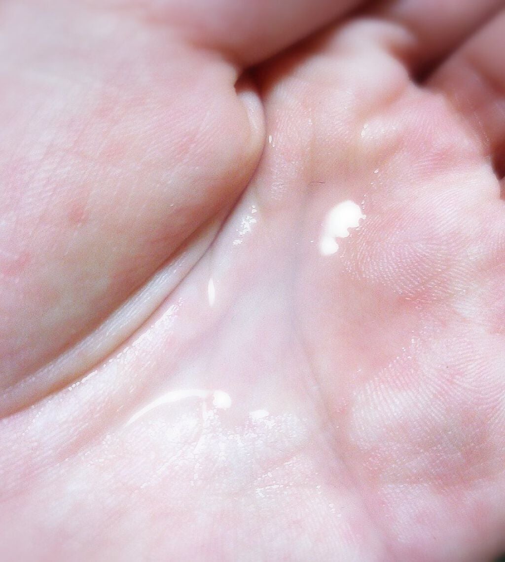 薬用化粧水/スキンライフ/化粧水を使ったクチコミ(2枚目)