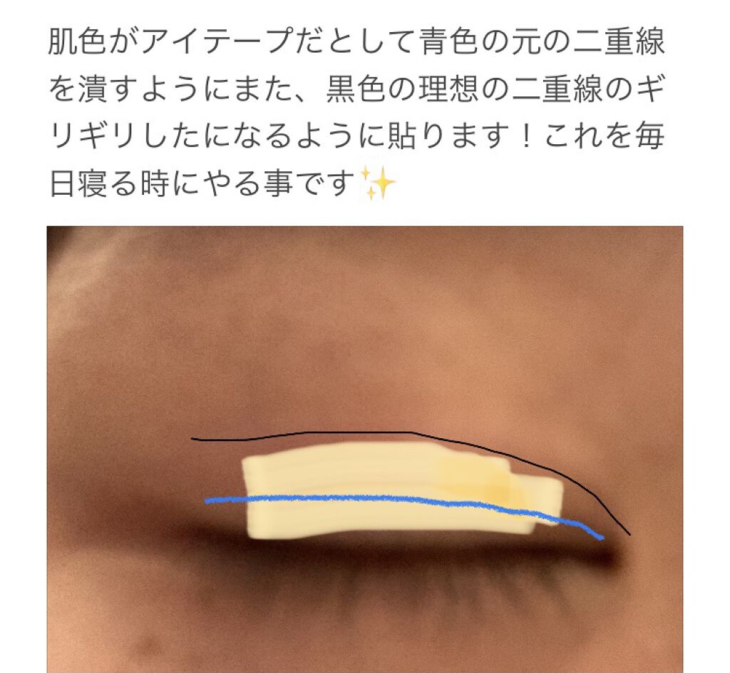 ヘアピン/LUCKY/ヘアアクセサリーを使ったクチコミ（3枚目）