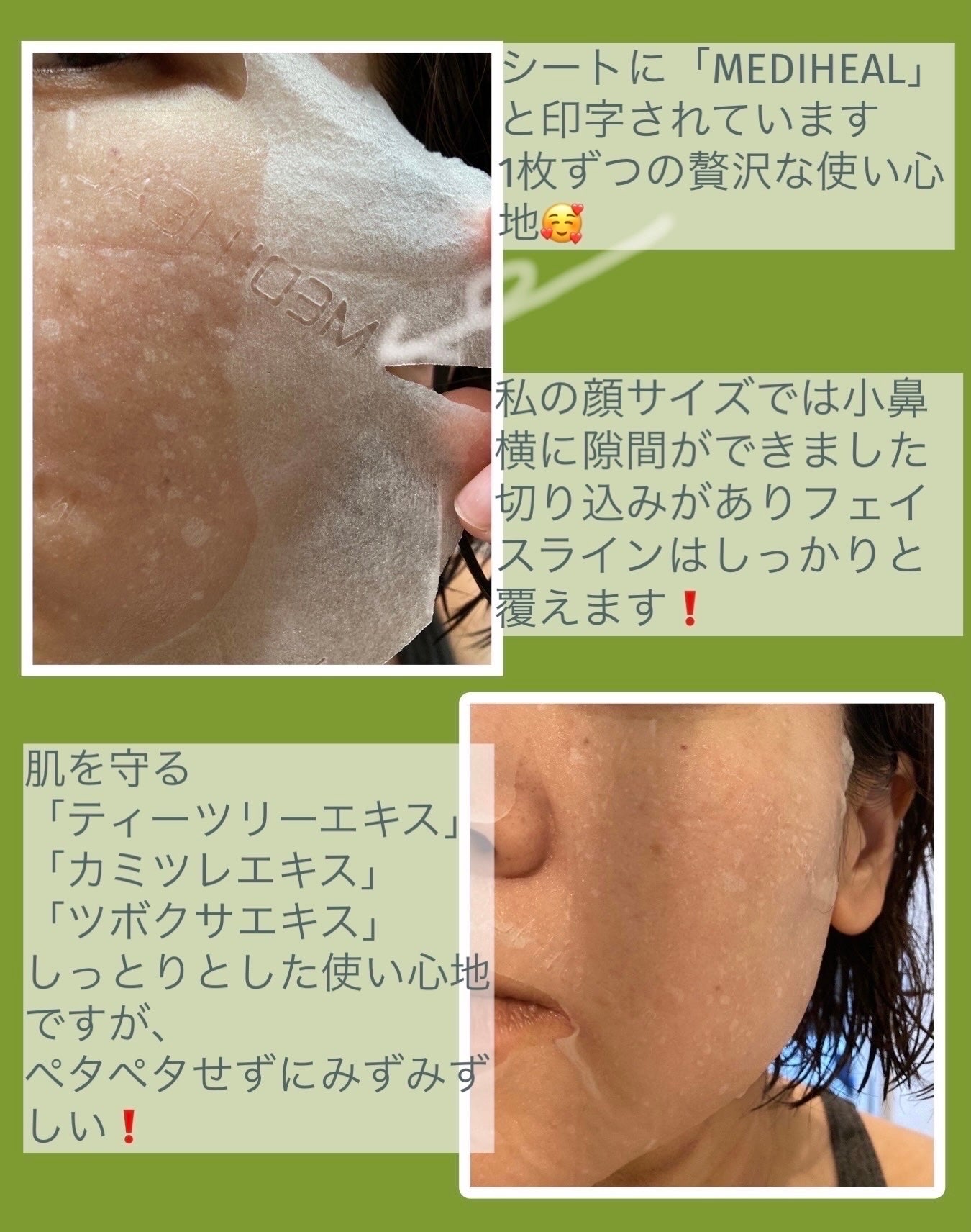 ティーツリーケアソリューション アンプルマスクJEX/MEDIHEAL/シートマスク・パックを使ったクチコミ(3枚目)