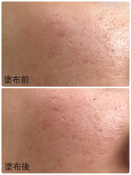 UVイデア XL プロテクショントーンアップ ローズ/ラ ロッシュ ポゼ/日焼け止めクリームを使ったクチコミ(6枚目)