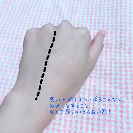 オルビスユー ジュレパック/オルビス/洗い流すパック・マスクを使ったクチコミ(4枚目)