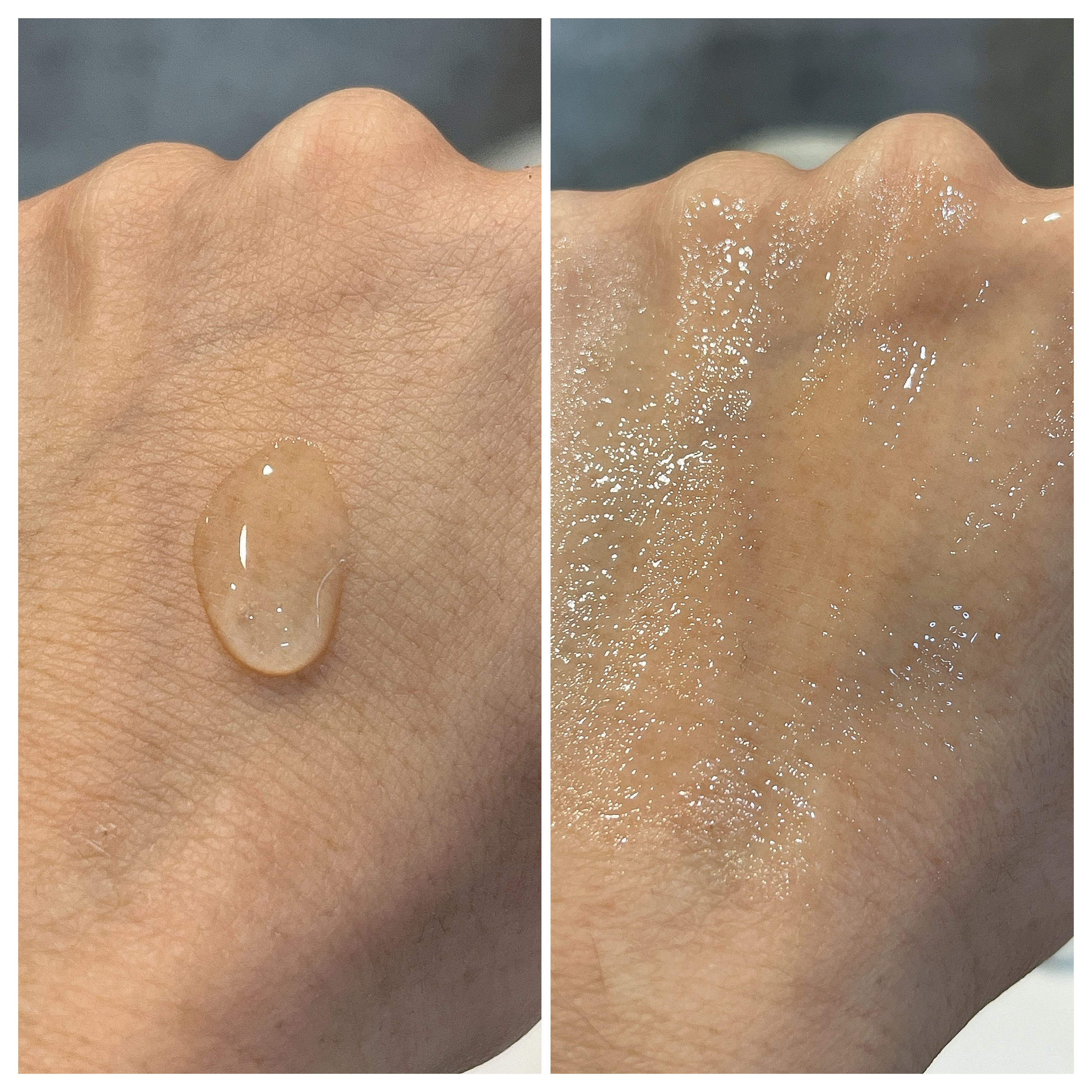 メディリフト ニードルリフトピールセラム/YA-MAN TOKYO JAPAN/美容液を使ったクチコミ（3枚目）