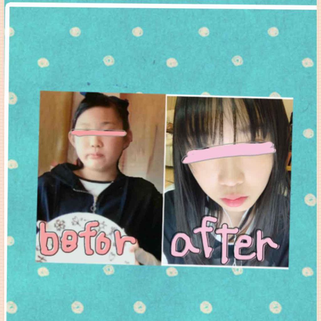 フェイストレーナー/DAISO/その他スキンケアグッズを使ったクチコミ(1枚目)