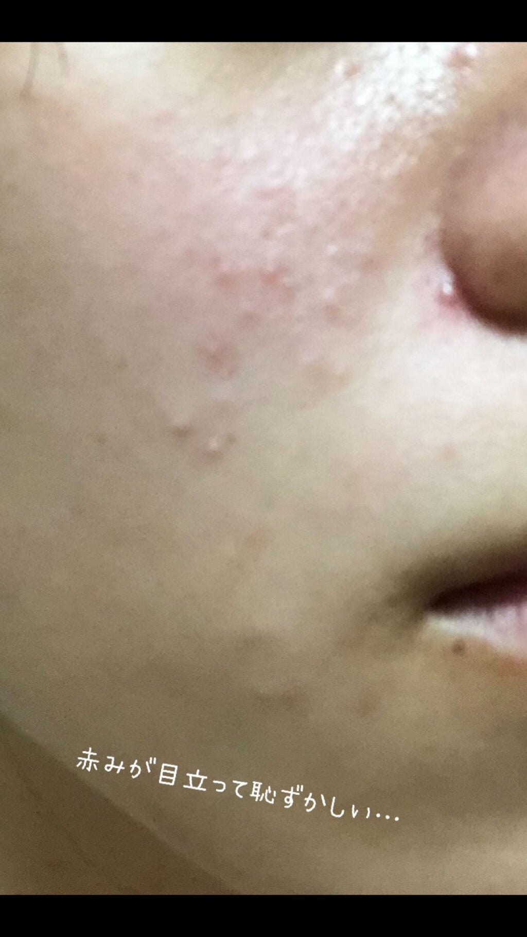 真琴 on LIPS 「初投稿です!変なところがあるかもしれませんが温かく見守ってくだ..」(3枚目)