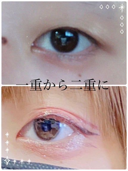 ワンダーアイリッドテープ Extra/D-UP/二重まぶた用アイテムを使ったクチコミ(1枚目)