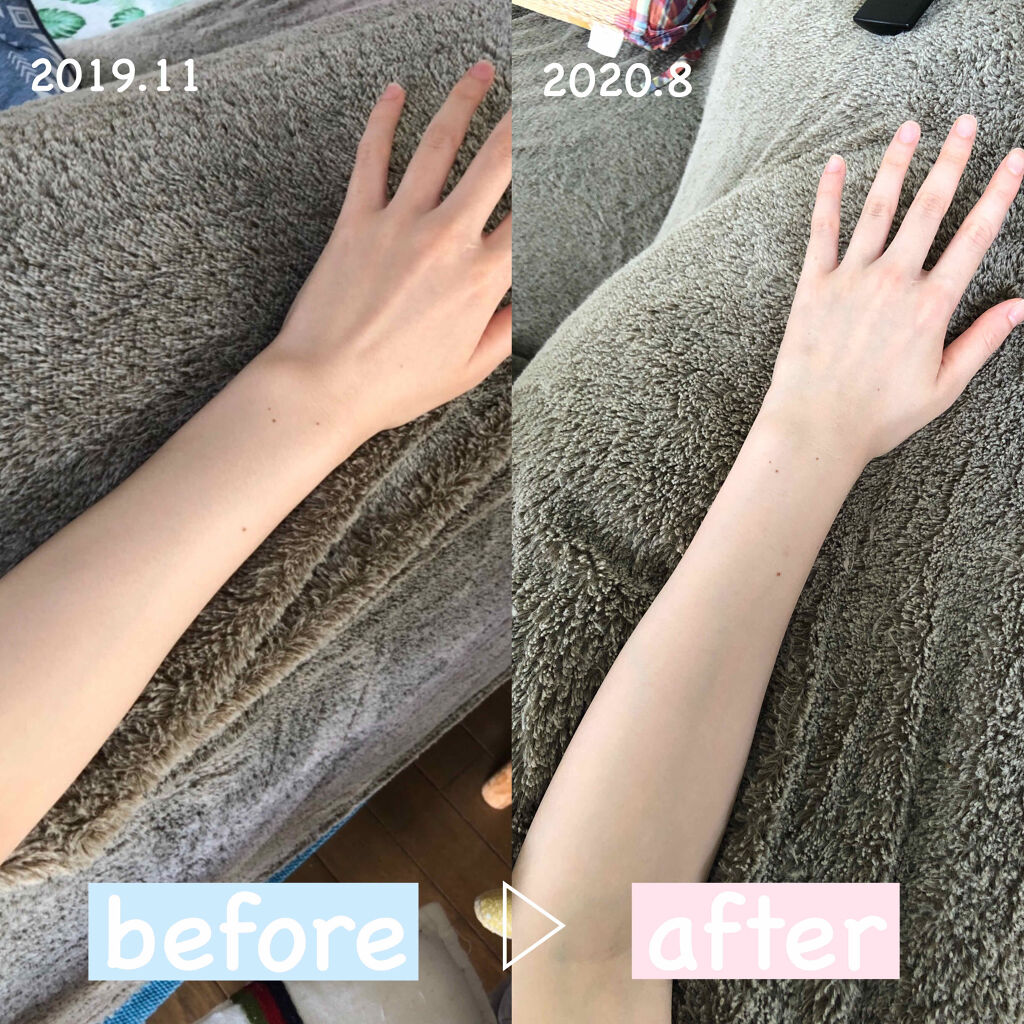 エバレッシュホワイトEXⅡ(医薬品)/matsukiyo/その他を使ったクチコミ（1枚目）