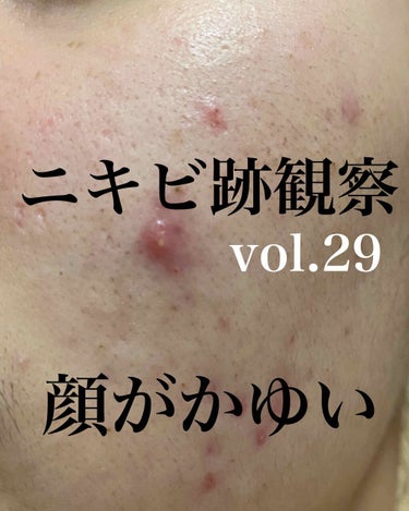 敏感肌用薬用美白美容液/無印良品/美容液を使ったクチコミ（1枚目）