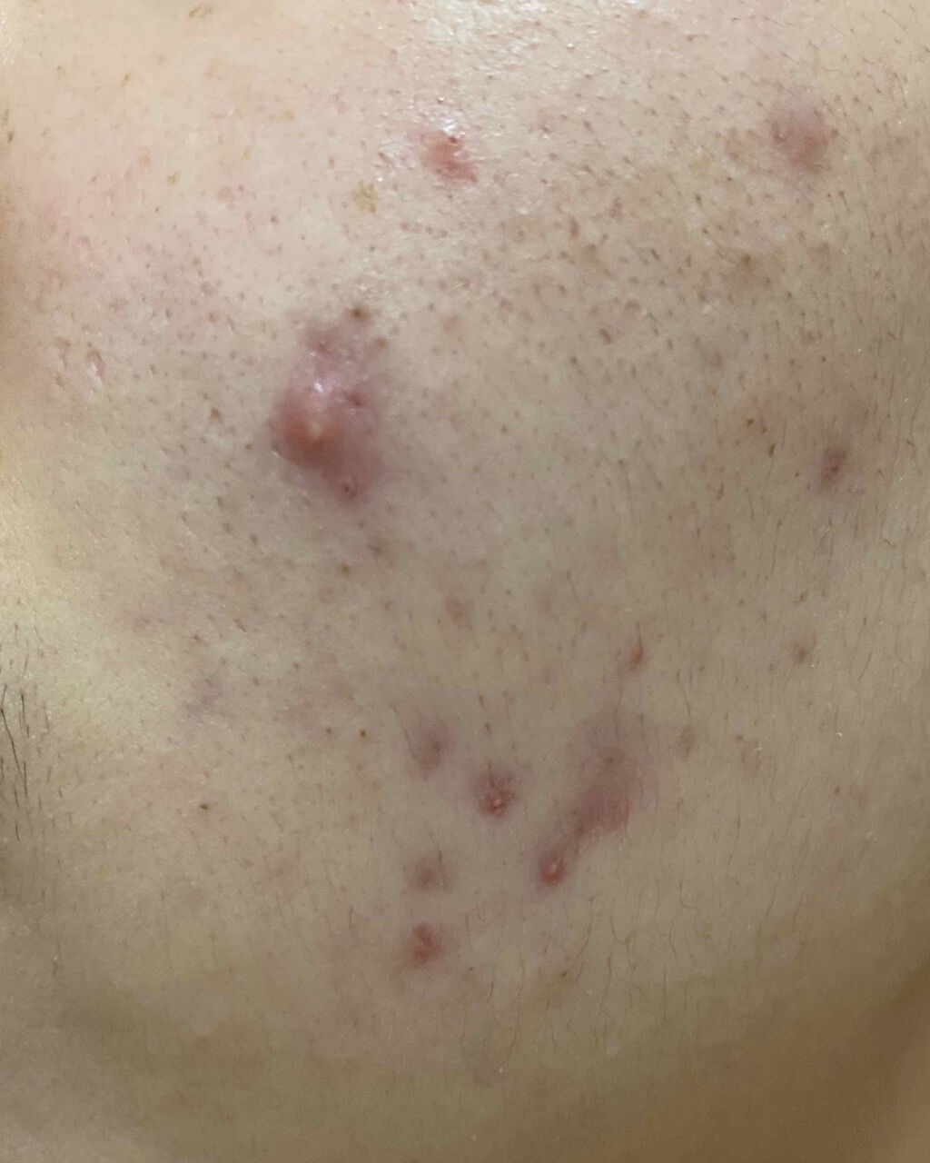 敏感肌用薬用美白美容液/無印良品/美容液を使ったクチコミ(3枚目)