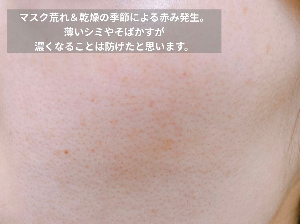 エリクシール ホワイト スポットクリアセラム WT/エリクシール/美容液を使ったクチコミ(3枚目)