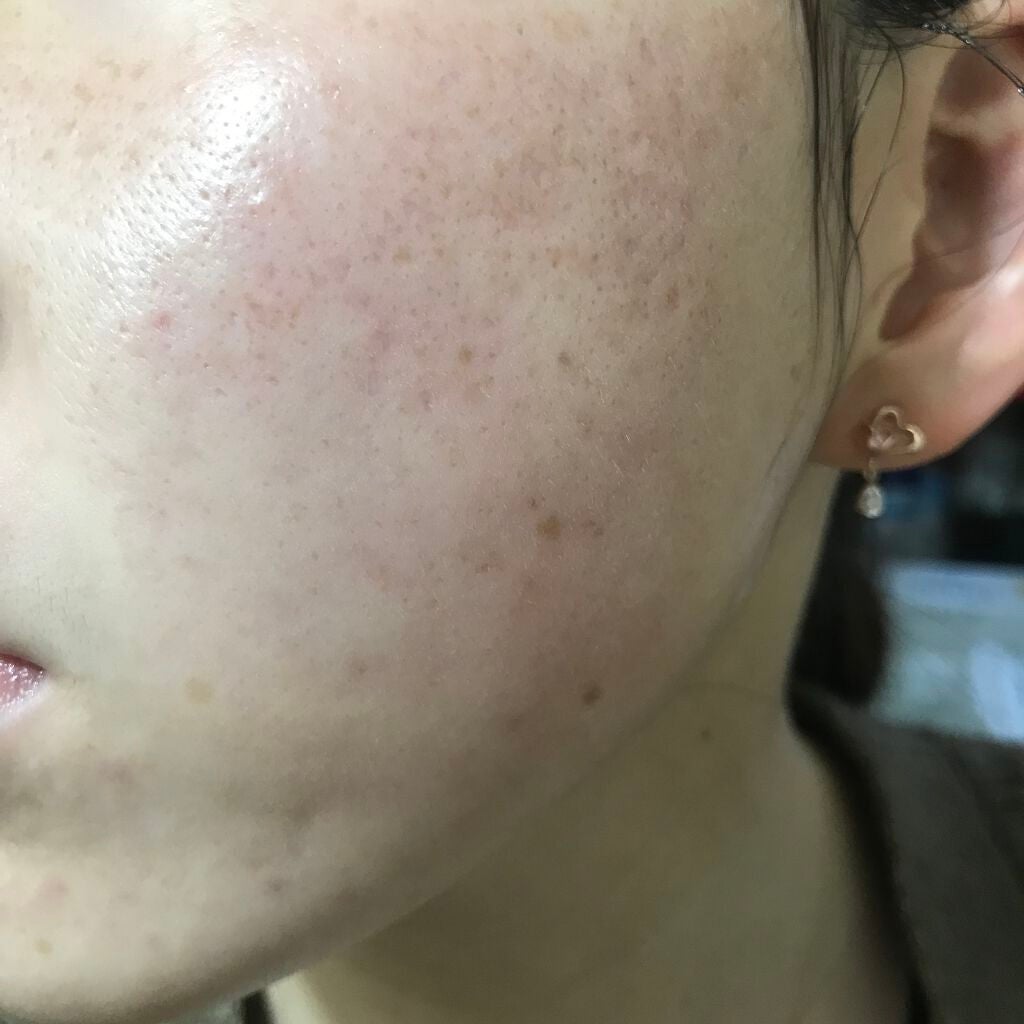 Amino Acid+B5/The Ordinary/美容液を使ったクチコミ(2枚目)