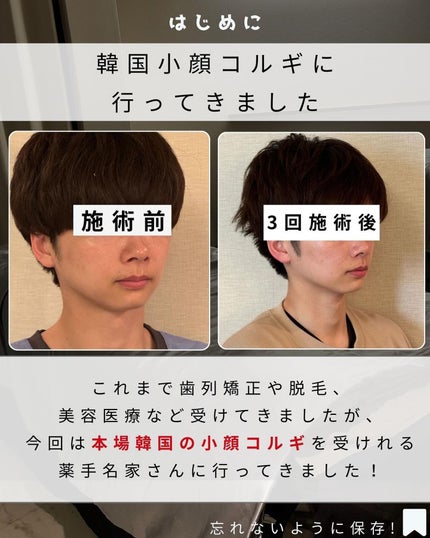 ヨウ | 31歳の老けない暮らし on LIPS 「これまで歯列矯正、脱毛、美容医療など受けてきましたが、密かに小..」(2枚目)
