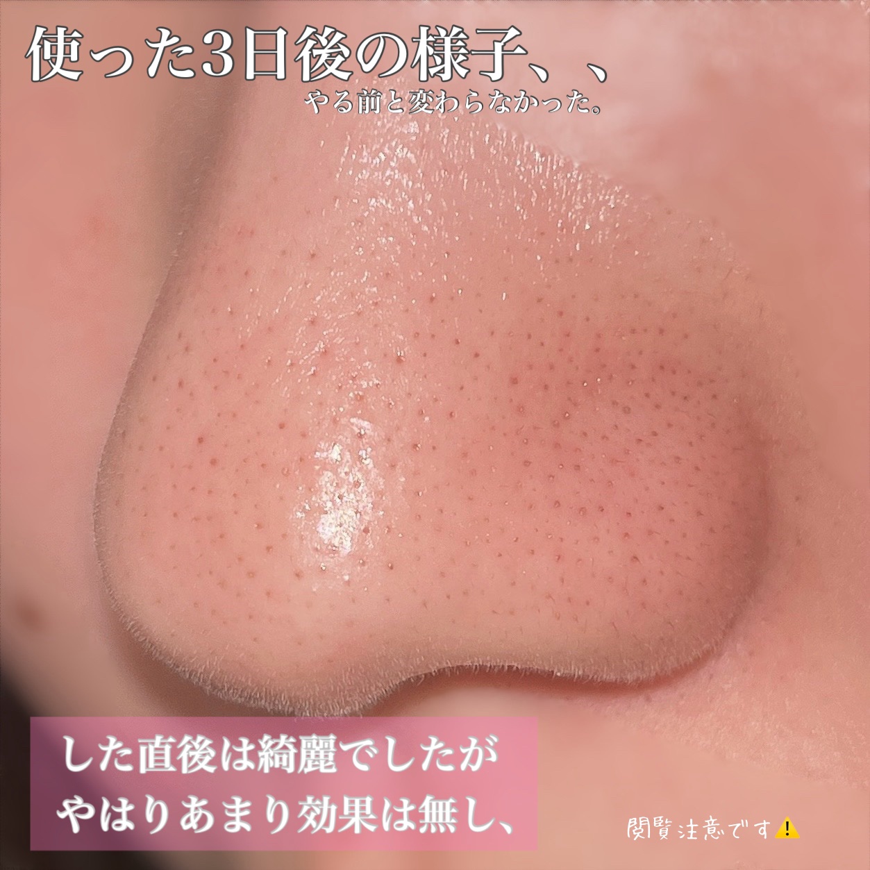 毛穴モップ (3STEP NOSE PACK)/YAMMY’S TOY/洗い流すパック・マスクを使ったクチコミ（3枚目）