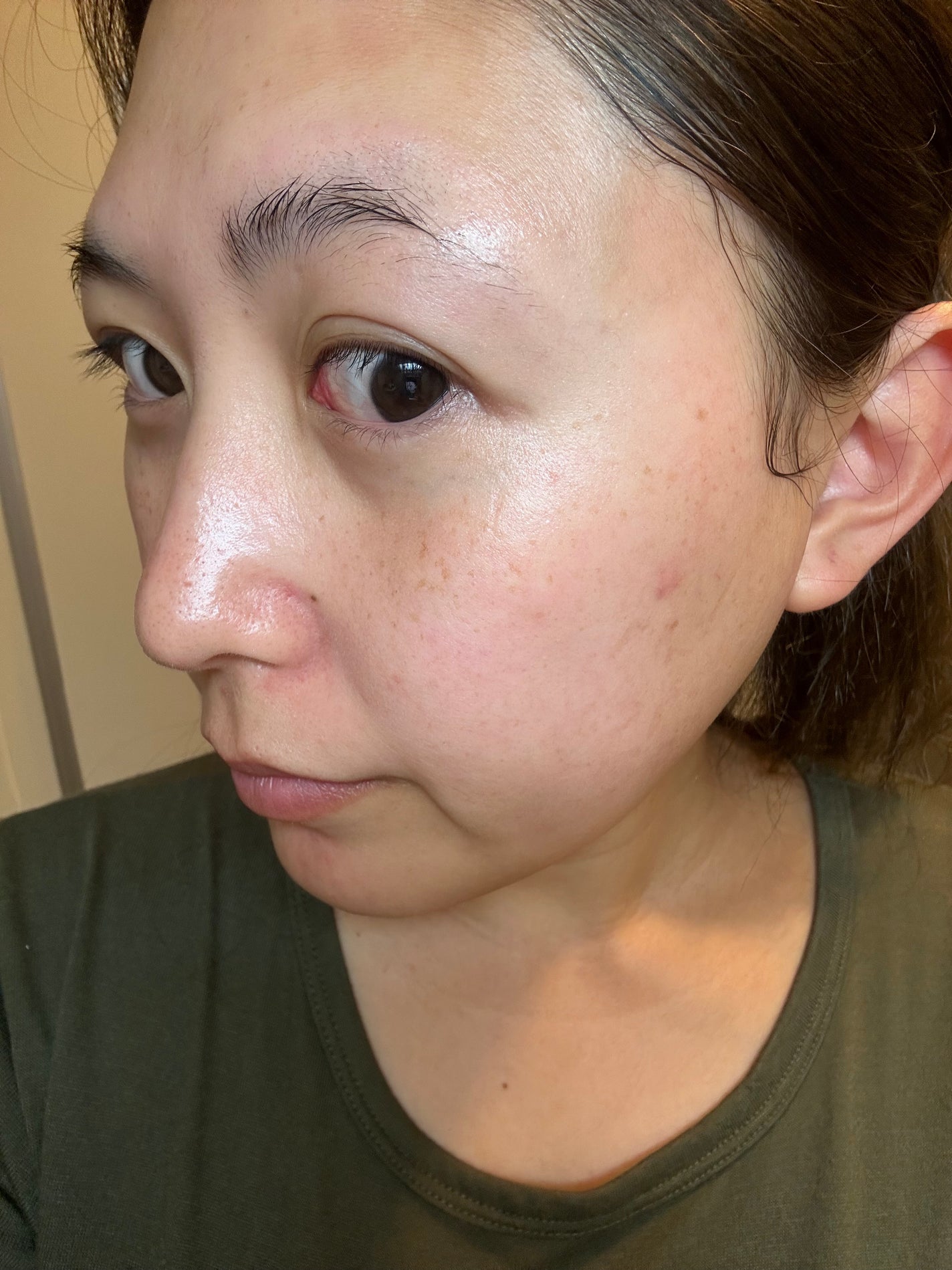 ネイチャーコンク 薬用クリアローション/ネイチャーコンク/拭き取り化粧水を使ったクチコミ(6枚目)