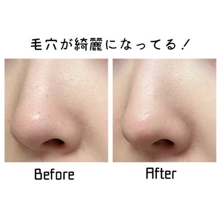 モデリングパック/Sunnicorn/シートマスク・パックを使ったクチコミ(5枚目)