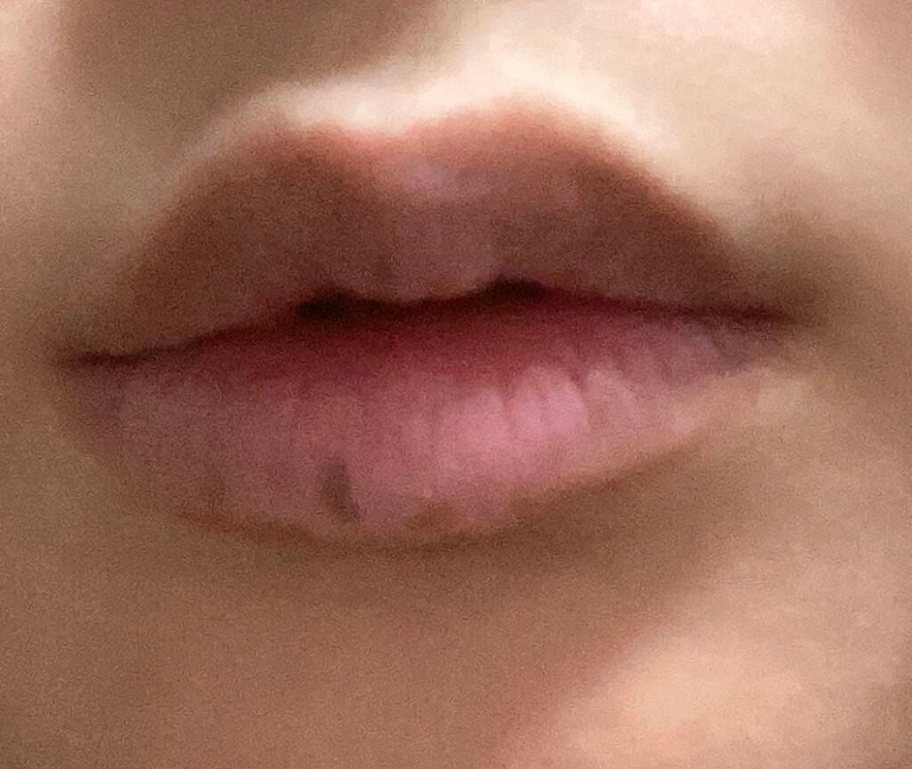 モアリップ N (医薬品)/資生堂薬品/その他を使ったクチコミ(2枚目)