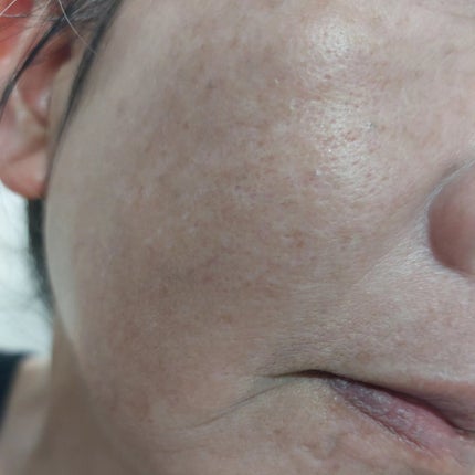 カロテン毛穴レスクレイパック/APRILSKIN/洗い流すパック・マスクを使ったクチコミ(6枚目)