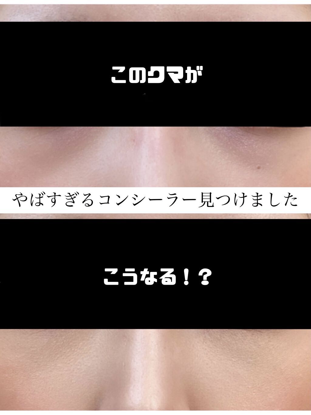 トーンパーフェクティング パレット 02 ナチュラルベージュ/DECORTÉ/パレットコンシーラーを使ったクチコミ（1枚目）