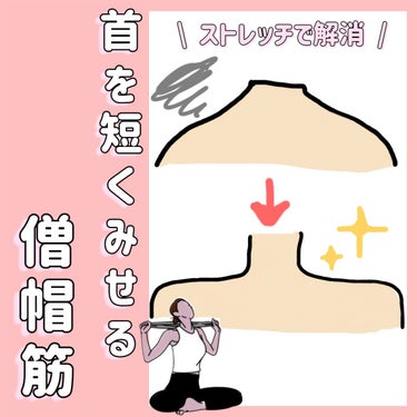 
\ もっこり肩の解消を！ /

僧帽筋がもっこりしてて気になる！？


ズバリ！


肩ボトックス！


...ももちろんですが、お家で時間があるたびにコツコツとストレッチすることも大切です☺️


