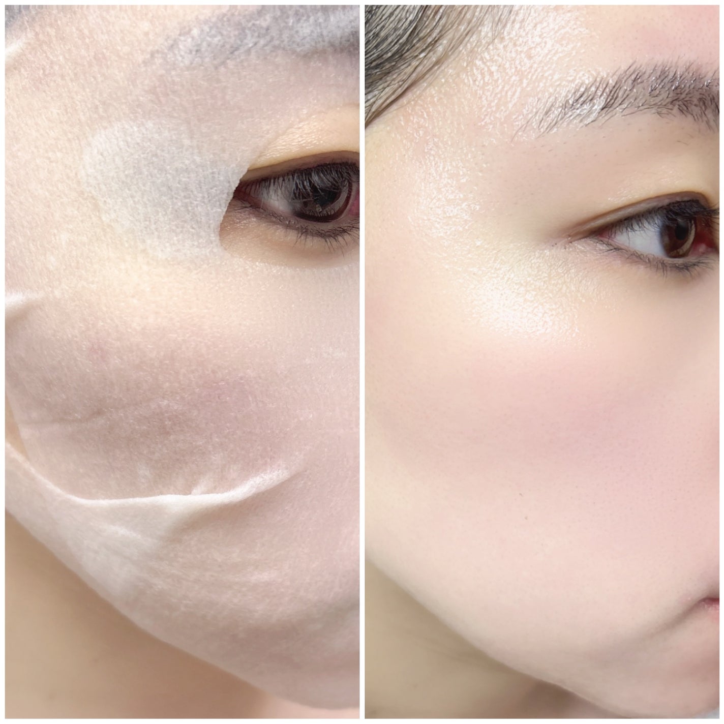 ルルルンプレシャス GREEN(バランス)【旧】/ルルルン/シートマスク・パックを使ったクチコミ(5枚目)