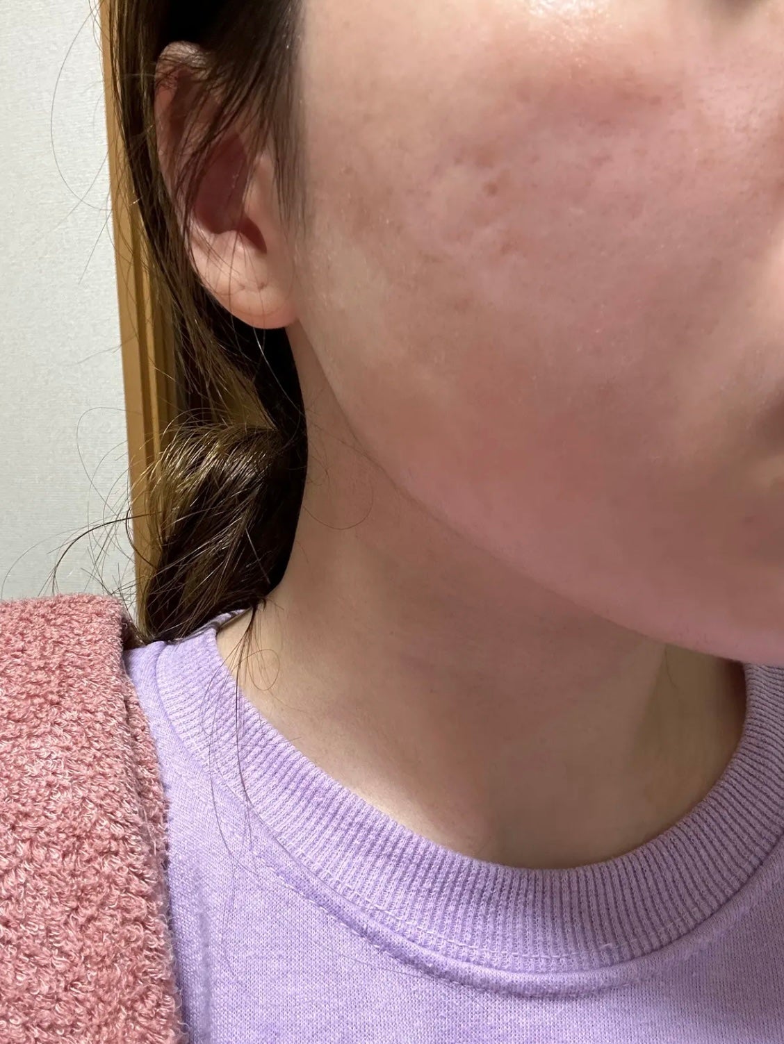 明色美顔水 薬用化粧水/美顔/化粧水を使ったクチコミ(1枚目)