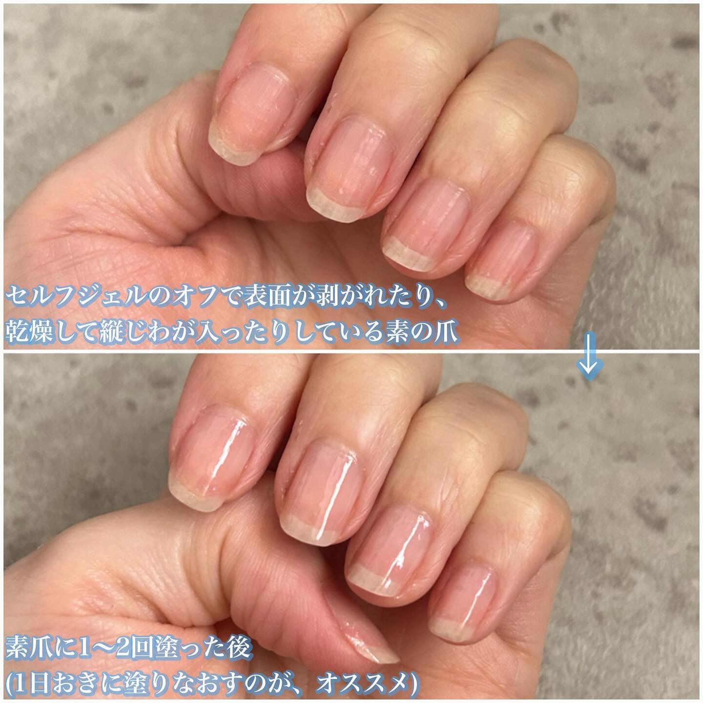 スーパー ストレングス ディフェンス/サリーハンセン/ネイルベースコートを使ったクチコミ（3枚目）