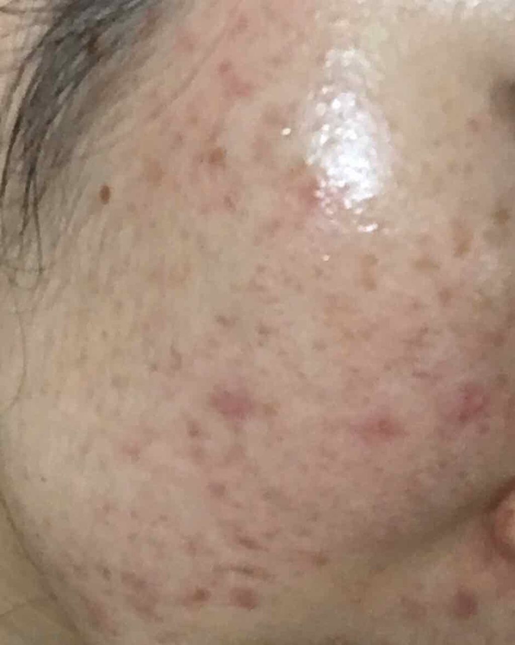 酵素ムース泡洗顔/メラノCC/泡洗顔を使ったクチコミ(2枚目)