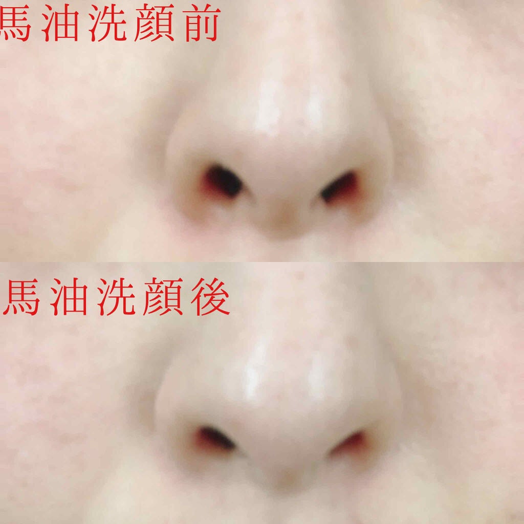 ソンバーユ無香料/尊馬油/ボディオイルを使ったクチコミ(2枚目)