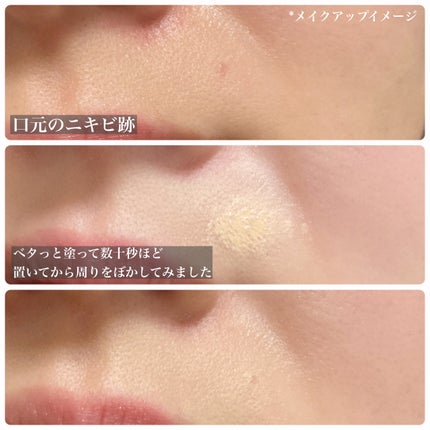 イプノス シーバムクリア リペアクリーム/ACSEINE/フェイスクリームを使ったクチコミ(3枚目)